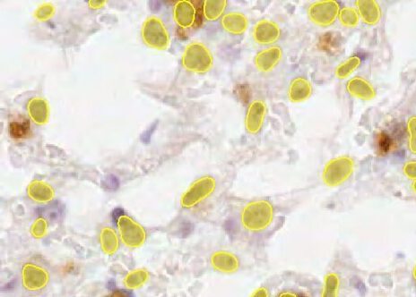 Stained Tissues & Colonies