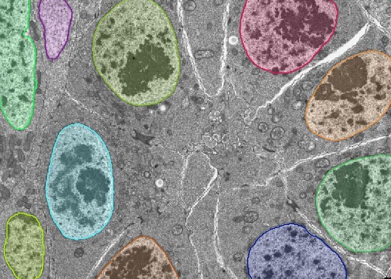 EM Heavy Metal Stained Cells